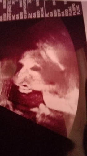 🤰🥳🥳👶👶👶