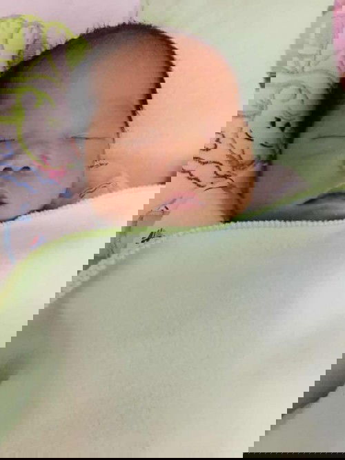 เปลี่ยนแผน😁
คลอดธรรมชาติ —-> ผ่าคลอด