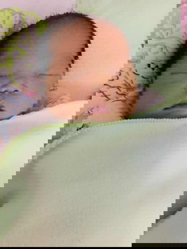 เปลี่ยนแผน😁
คลอดธรรมชาติ —-> ผ่าคลอด