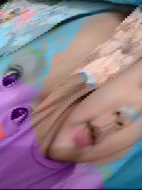 Mata anak trliht jereng