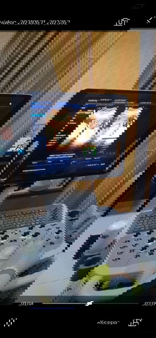 Bayi dirahim bisa cegukan kah ?