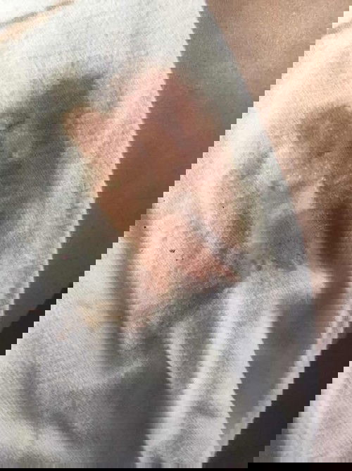 เลือดสีนํ้าตาลอ่อน?