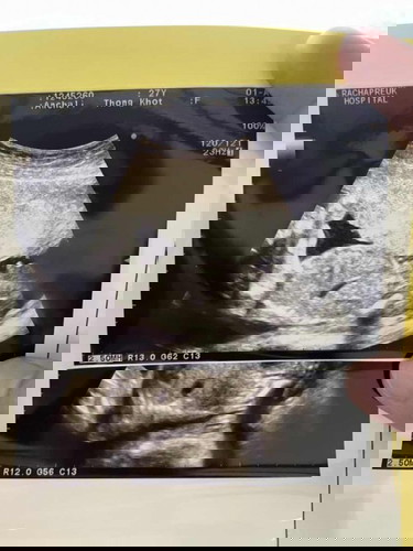 ตัวน้อยของแม่