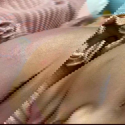 muka rusak bercak putih