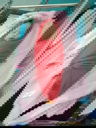 Bun bayi ku udh seminggu lebih gk pup..apakah normal?