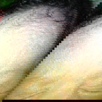 Keluar biji2 putih berair diseluruh tubuh bayi