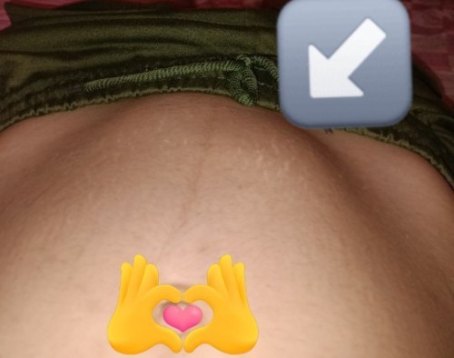 น้องฟูขึ้นมาบ่อยมาก แต่ไม่ค่อยตอดให้แม่รับรู้ ท้อง2คะ พึ่งได้15 สัปดาห์ มีปัญหาเลือดออก ปวดท้องน้อย