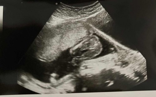 Mohon bantuan, rasanya ini baby girl atau boy?