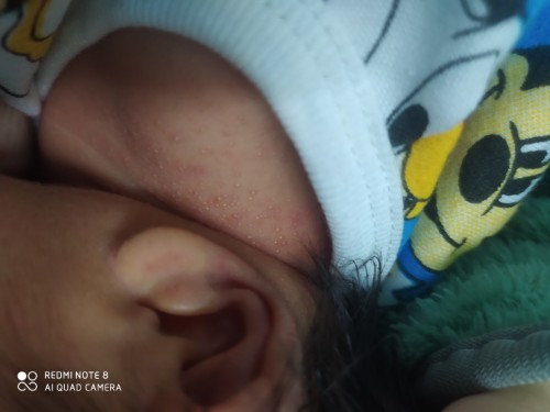 เเบบนี้เป็นอะไรคะ เเละต้องใช้ยาอะไรถึงจะหาย