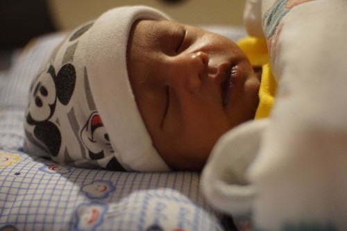 ปากล่างมีสีคลำแบบนี้เพราะอะไรครับ