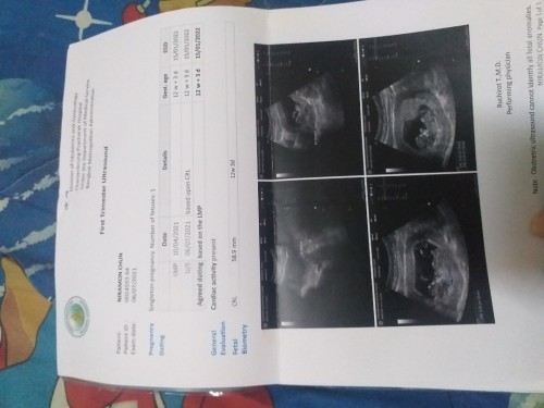 ดูน้ำหนักจากตรงไหนค่ะ