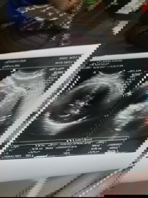 Apakah berat badan janin normal?