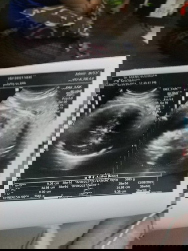 Apakah berat badan janin normal?