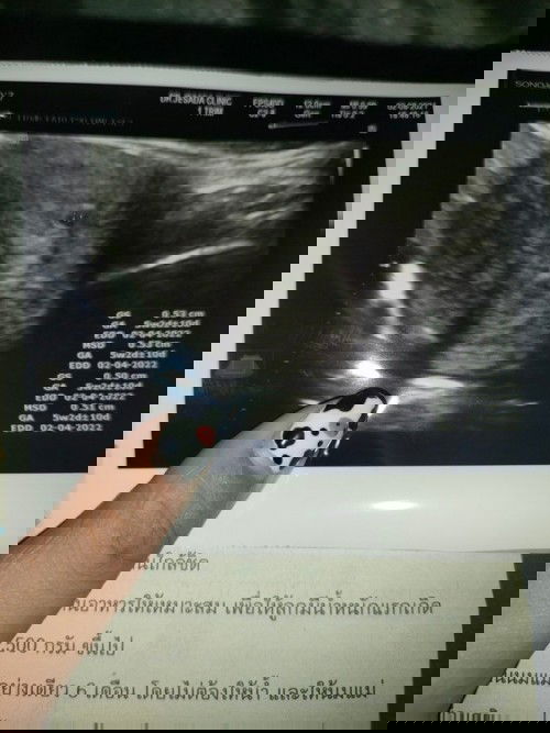 ฝากท้องคุณหมออัตราซาวด์