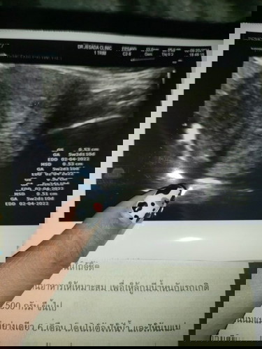 ฝากท้องคุณหมออัตราซาวด์