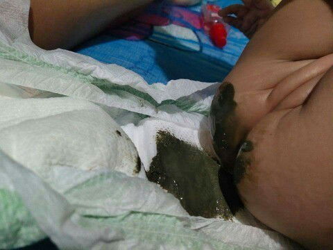 NESTOGEN LOW LACTOSE