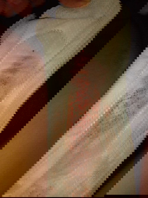 อยากถามว่าแบบนี้ใช่สีประจำเดือนปกติมั้ยคะ