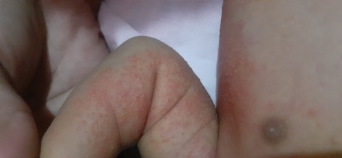 Bintik merah