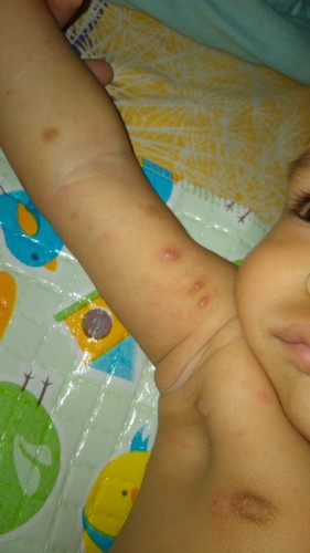 Mohon info obat yg ampuh