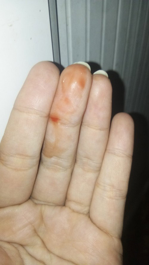 Flek coklat atau lendir