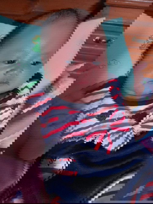 Bunda nnya dunk kn sy sdh mlhirkn dn ank sy msuk usia 1bln skrng tpi knp di  pipiny ad ky bruntusan