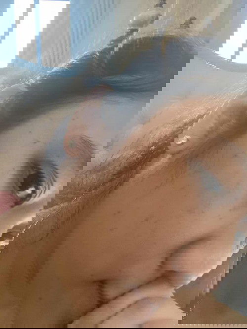 Bahayakah bintik merah ini??