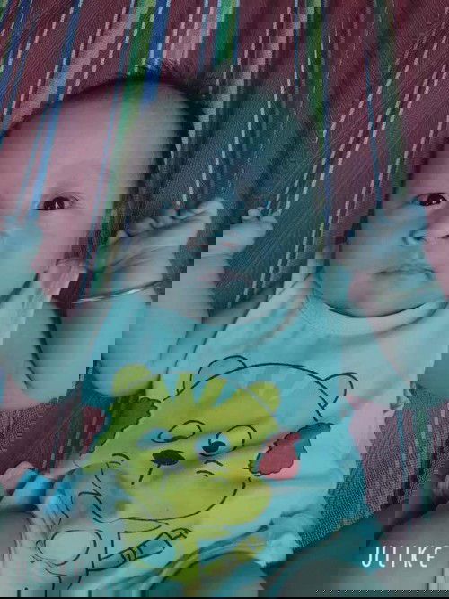 Bé nhà em 2 tháng tuổi cho em hỏi mắt nv có phải bị lác kh ạ 😣