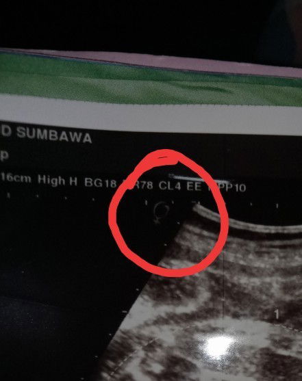 Pertanyaan Kehamilan