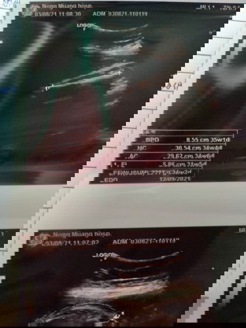 คุณแม่ตั้งครรภ์