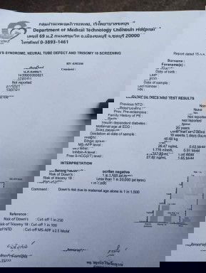 ผลตรวจดาวน์ซินโดรม​