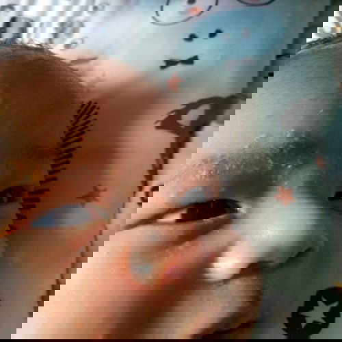 Bintik di wajah bayi