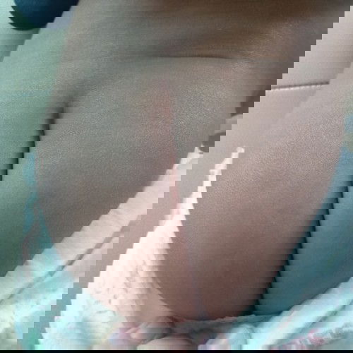 ถามแม่ๆหน่อยคะน้องผิวเป็นแบบนี้ต้องใช้ครีมอะไรทาให้น้องดีคะ