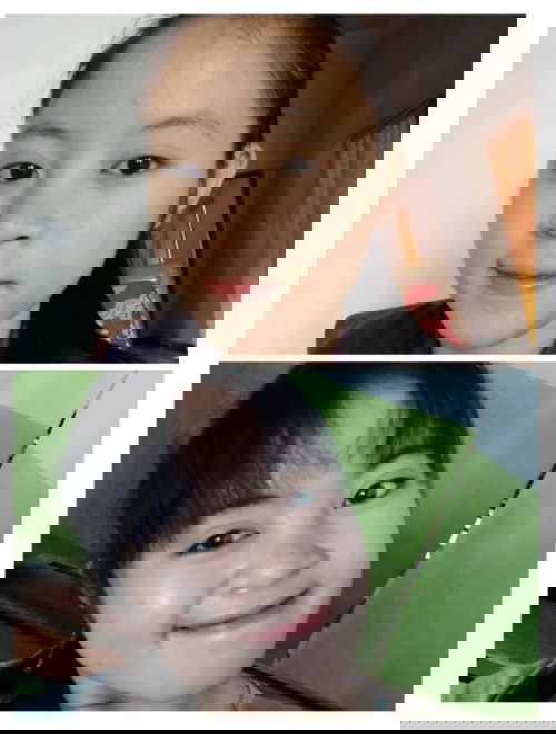 Sering dibully karena kondisi wajah saat hamil