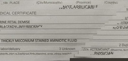 caused of death :
malapot na panubigan