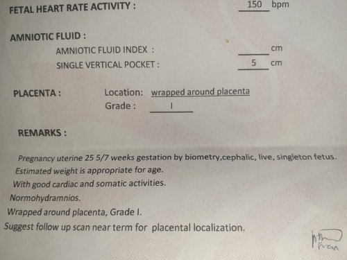 Wrapped around placenta