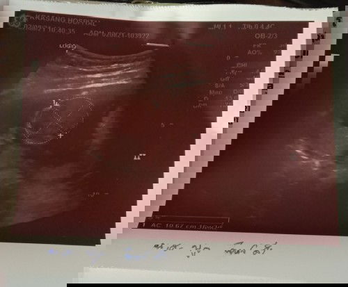 ขอถามคุณแม่หน่อยค่ะ