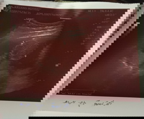 ขอถามคุณแม่หน่อยค่ะ