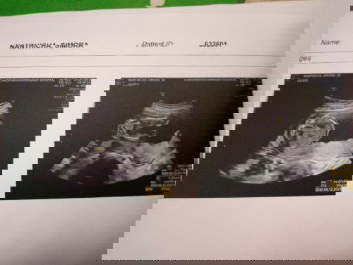 แม่ว่ามีจู๋มั้ยคะ หมอบอกเป็นจู๋จ้า😂👶❤️🙏