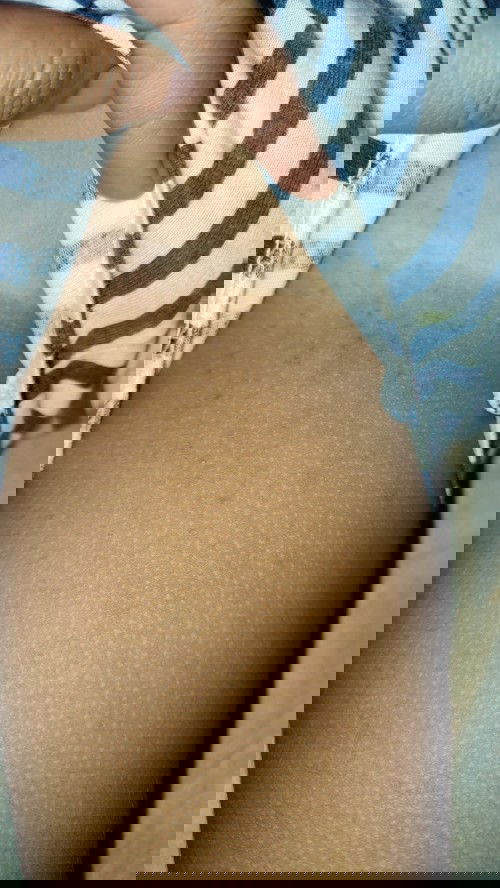 sharing krim bayi sensitif