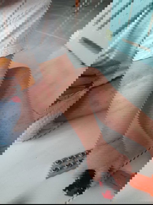 Toddler itching at night!