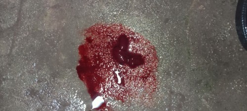 เครียด😔😥