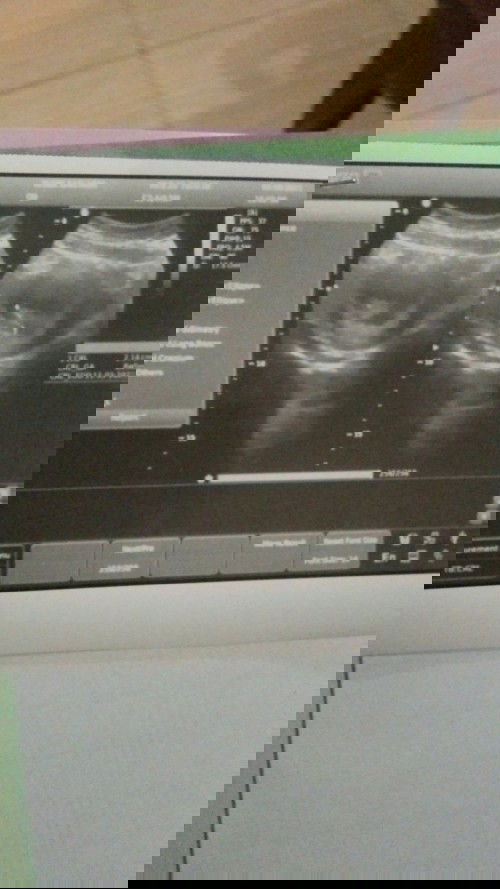 Alhamdulillah positif