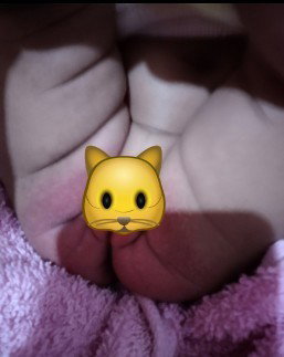 Rekomendasi Sabun Untuk alergi popok