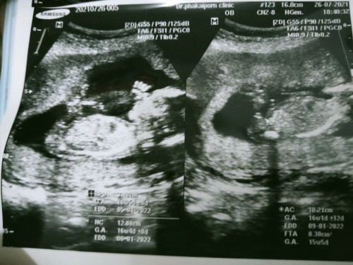 กำวันคลอดวันไหน