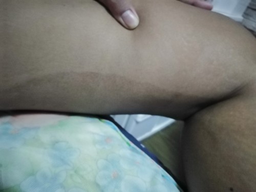 37weekมีแม่คนใหนเป็นบ้างคะ