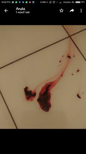 Darah haid atau apa?