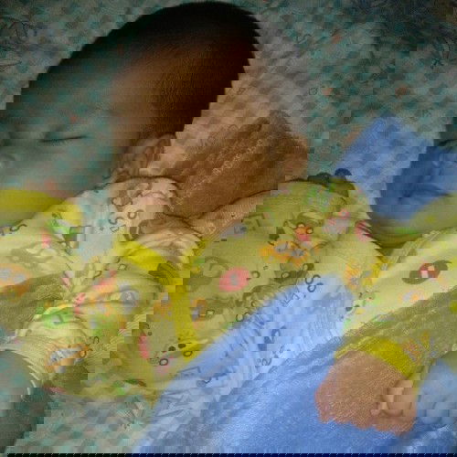 Anak usia 2bulan dikasih sufor + SUN