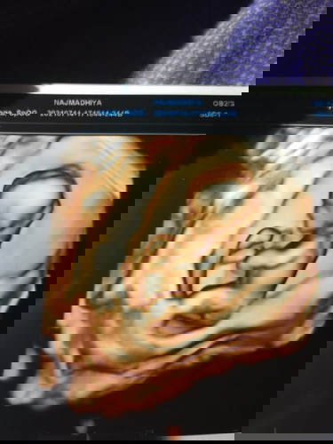 Apakah usia kandungan 4 bulan bayi sudah mulai aktif?