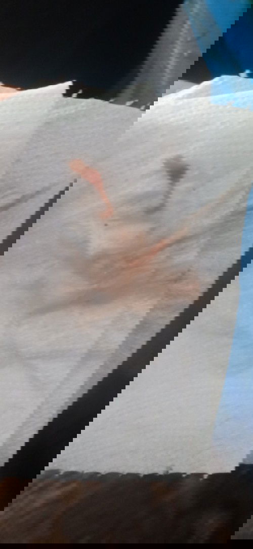 ตั้งครรภ์ได้ 26 สัปดาห์แล้วมีเลือดออกนิดหน่อย ไปหาหมอแล้วหมอบอกภาวะแท้งคุกคาม