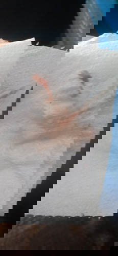 ตั้งครรภ์ได้ 26 สัปดาห์แล้วมีเลือดออกนิดหน่อย ไปหาหมอแล้วหมอบอกภาวะแท้งคุกคาม